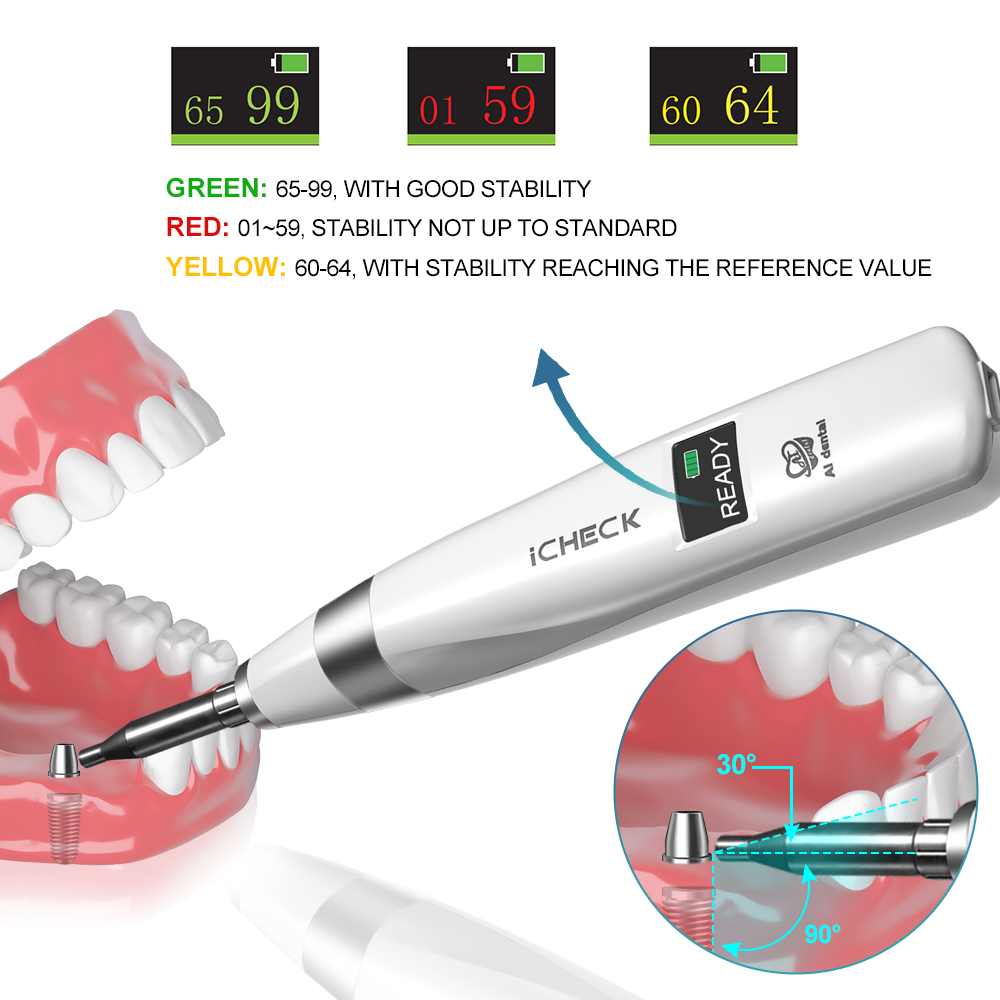 AI Dental Implant Stability Me - Stabilizer Screw In ulasan dan harga