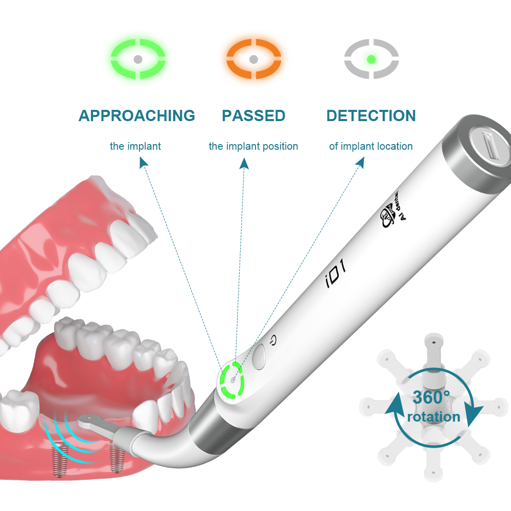 AI Dental Implant Stability Me - Stabilizer Screw In ulasan dan harga